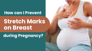 How to remove stretch marks on breast, types of stretch marks on breast, How to get rid off stretch marks on breast, Stretch marks on breast after pregnancy